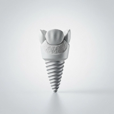 Close-up of a dental implant model with a bright, sterile background, no text, no words, no typography, no labels, clean image