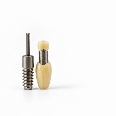 Close-up of a dental implant model showing the titanium post, abutment, and crown, on a sterile white background, no text, no words, no typography, no labels, clean image